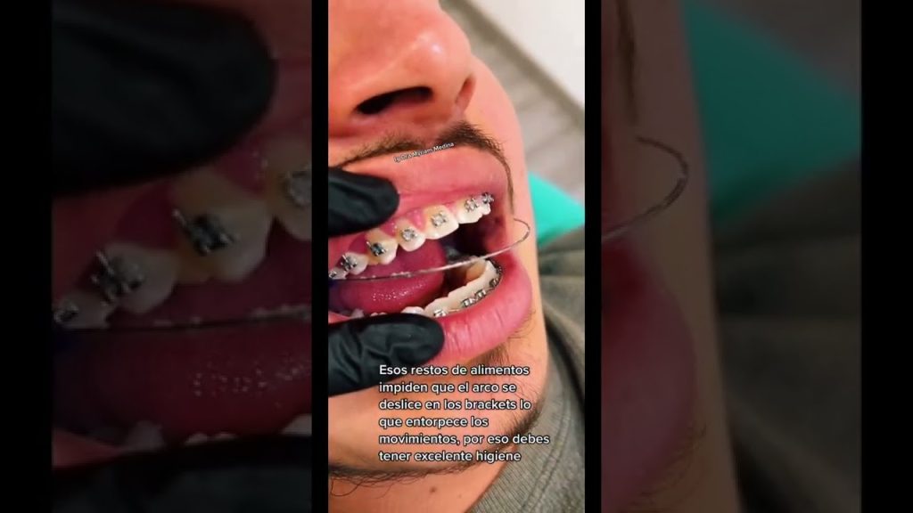 Dentista en  Albillos