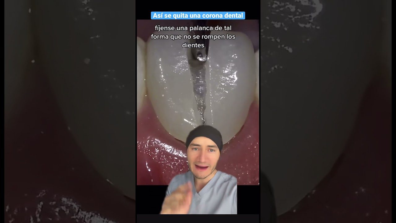 Dentista en  Cabezón de la Sierra