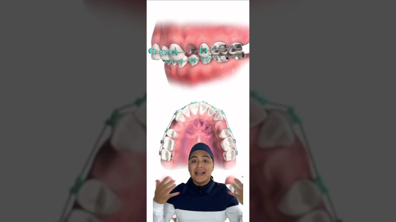 Dentista en  Sora