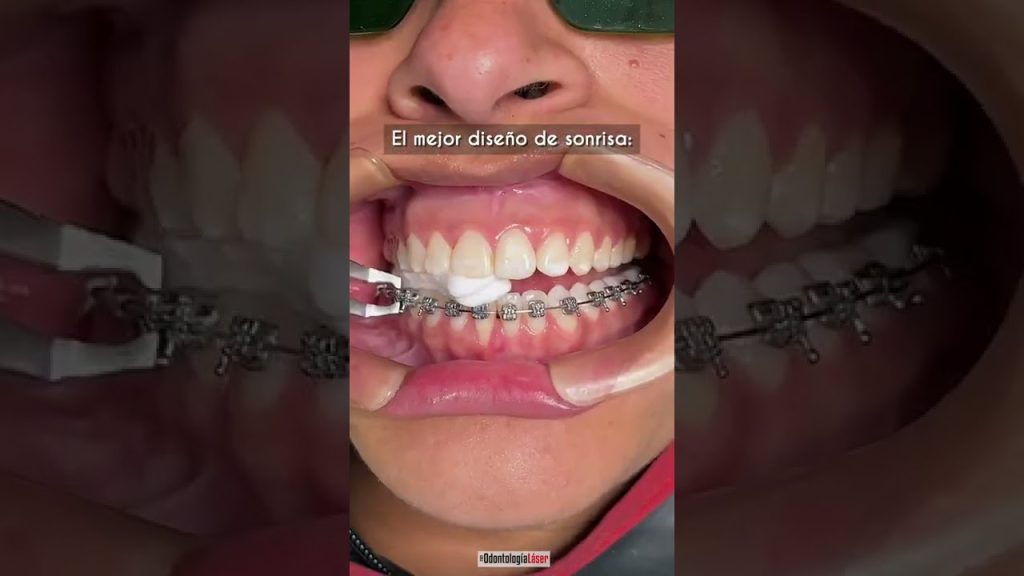 Dentista en  Ullastrell