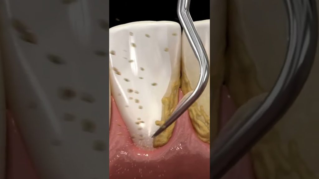 Dentista en  Vacarisses