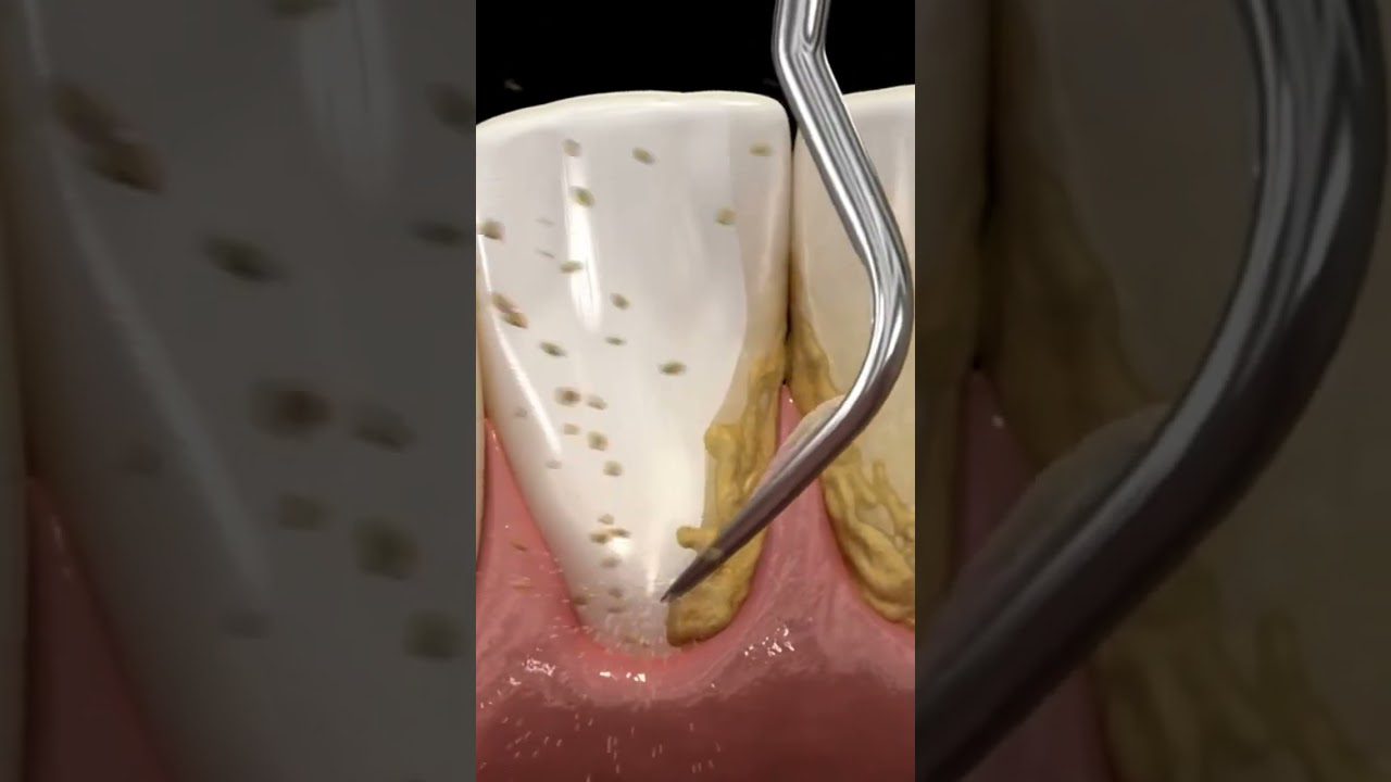 Dentista-en-Vacarisses - i-Healthcare Dentista en Vacarisses