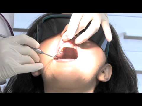 Dentista-en-Vic - i-Healthcare Dentista en Vic