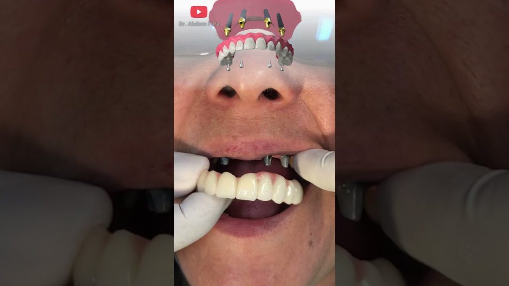 Dentista en  Vilada