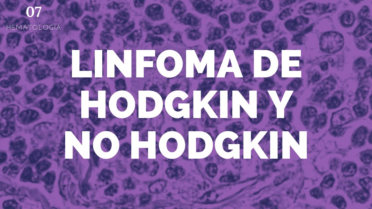 Como-el-linfoma-ha-afectado-a-celebridades-hispanoamericanas - i-Healthcare Cómo el linfoma ha afectado a celebridades hispanoamericanas