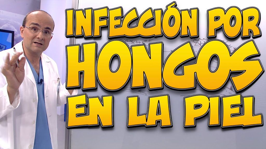 Cómo identificar y tratar las infecciones por hongos