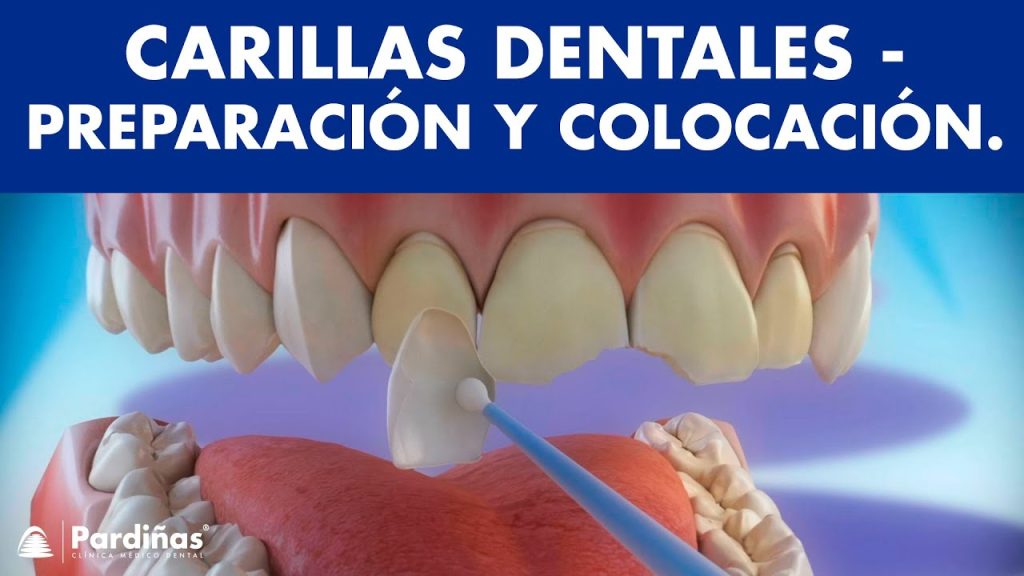 Dentista en  Carrias