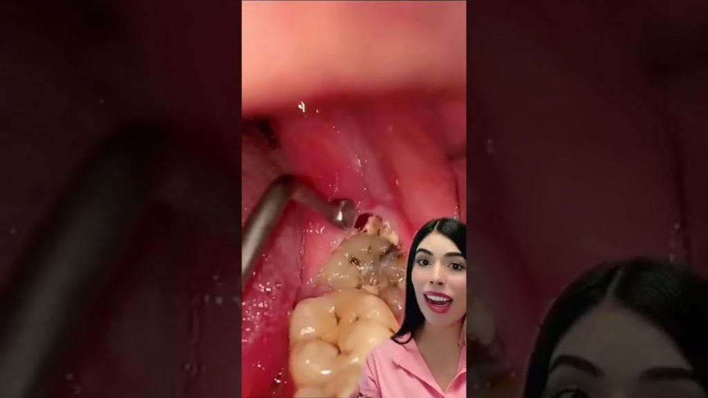 Dentista en  Cascajares de la Sierra