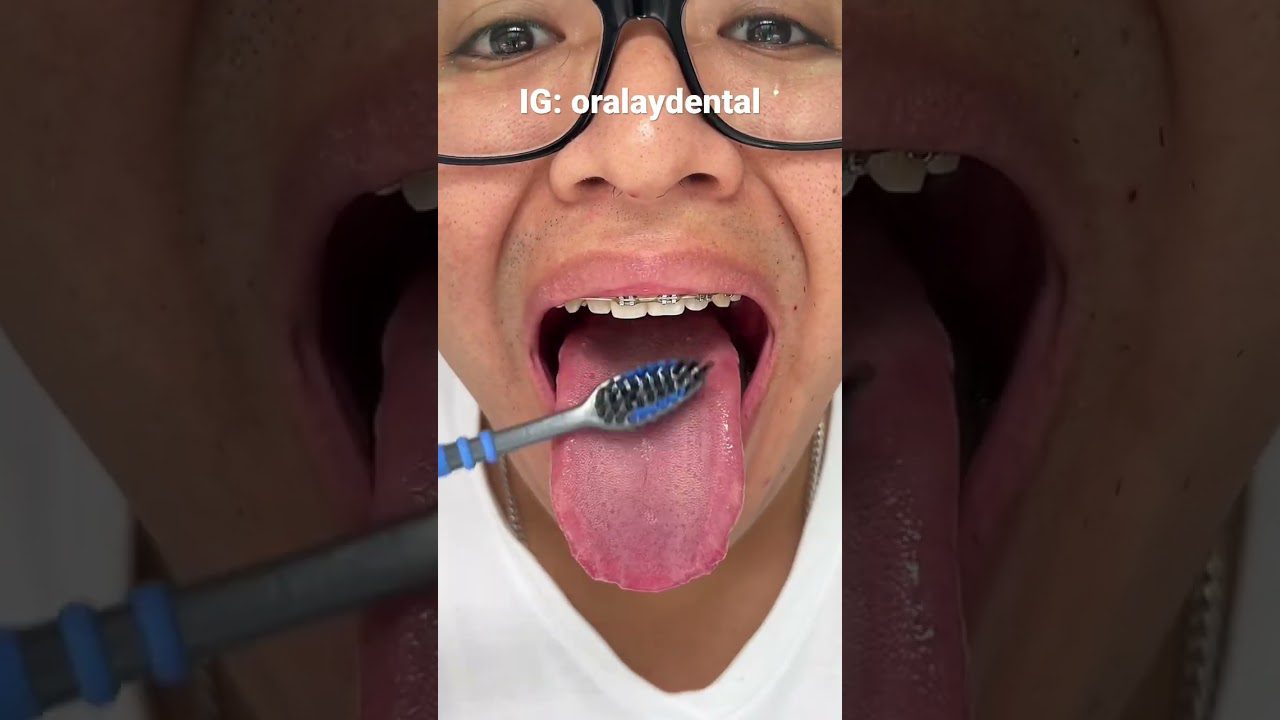 Dentista-en-Cillaperlata - i-Healthcare Dentista en Cillaperlata