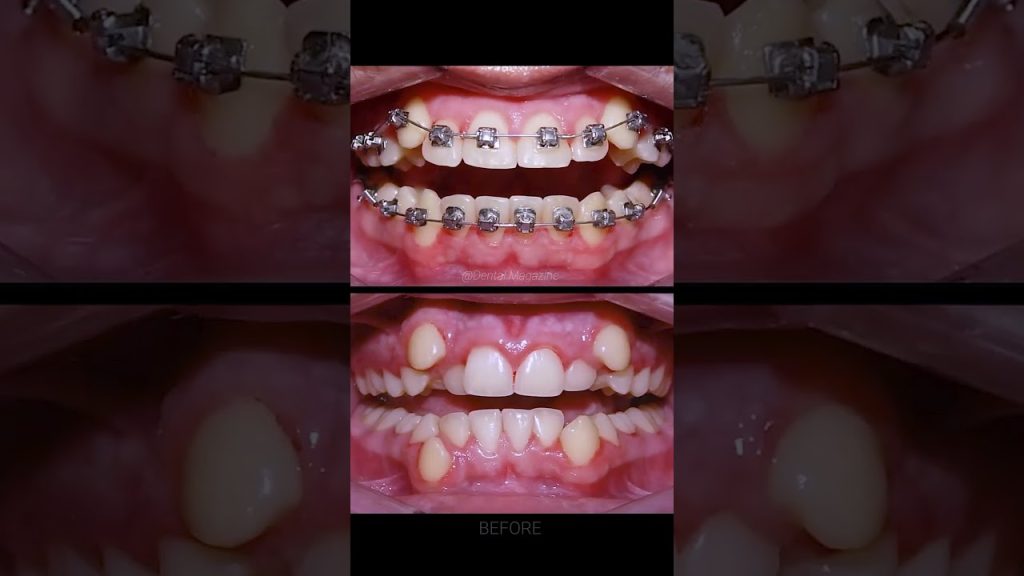 Dentista en  Estépar