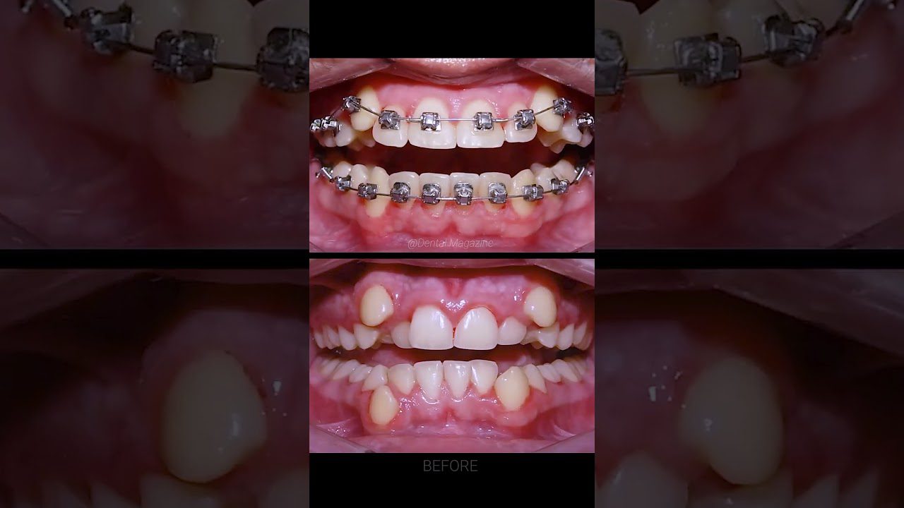 Dentista en  Estépar