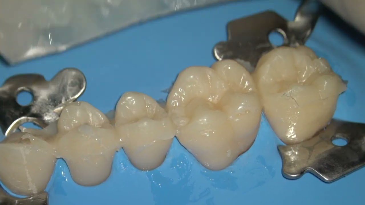 Dentista en  Fuentelcésped