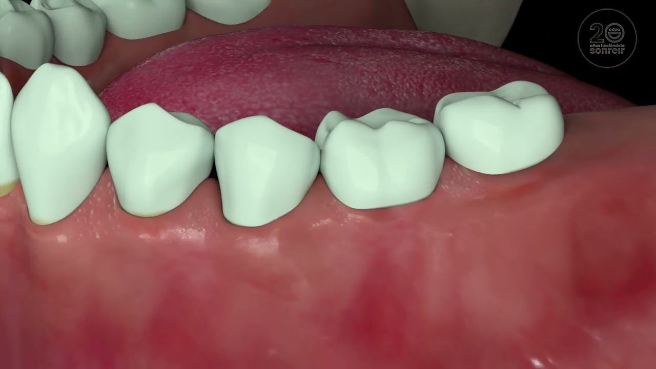 Dentista en  Nebreda