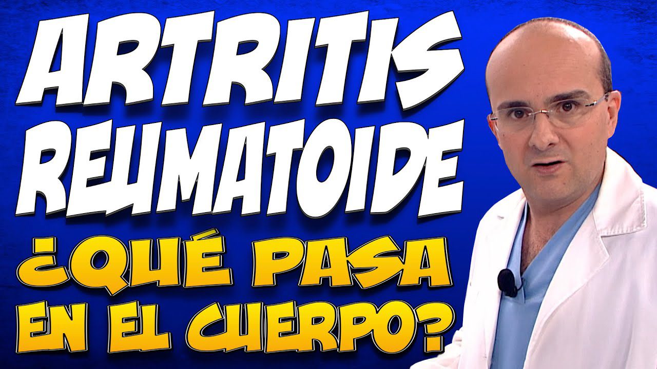 El impacto de la artritis reumatoide en la carrera de famosos hispanos