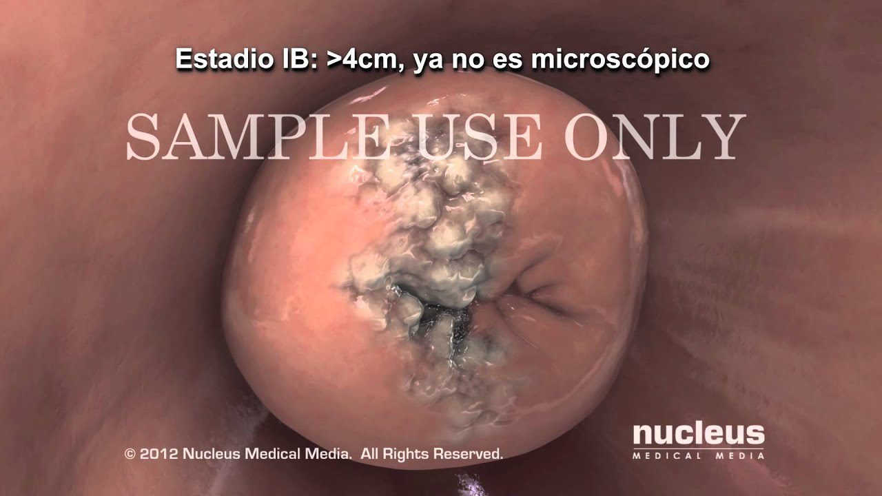 El impacto del cáncer cervical en la vida de artistas hispanas