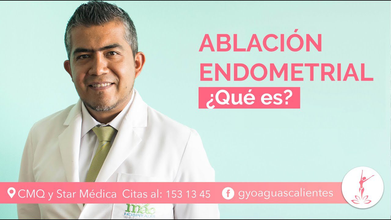 Todo lo que necesitas saber sobre la ablación endometrial