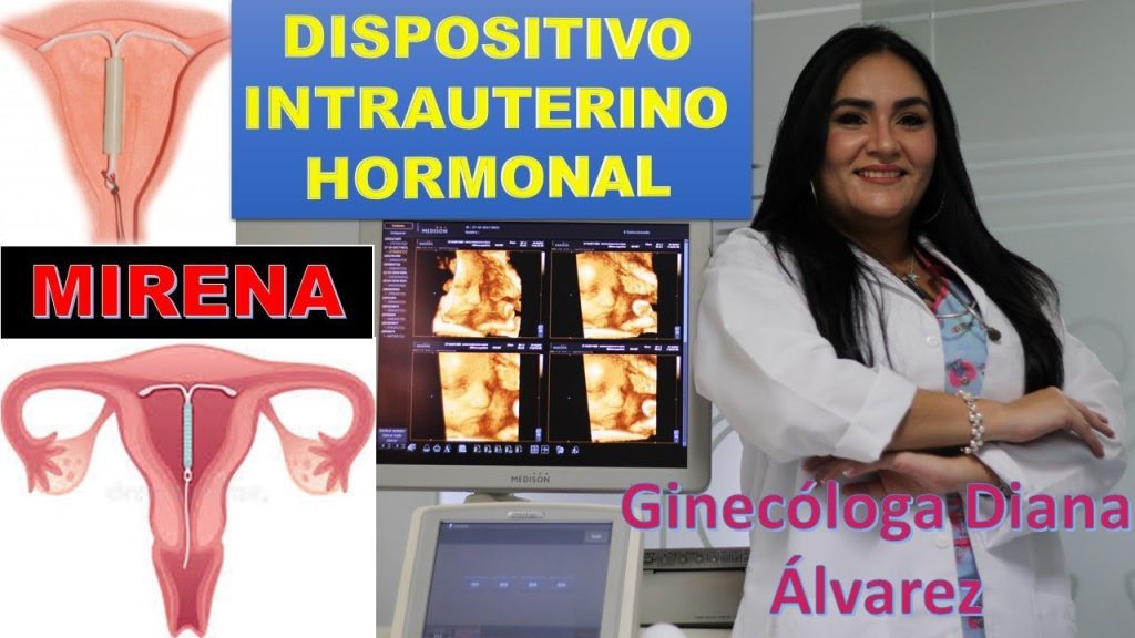 Todo lo que necesitas saber sobre los dispositivos intrauterinos