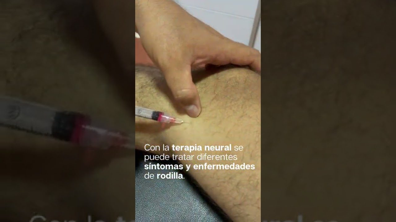 Clínica de Fisioterapia en Monroy