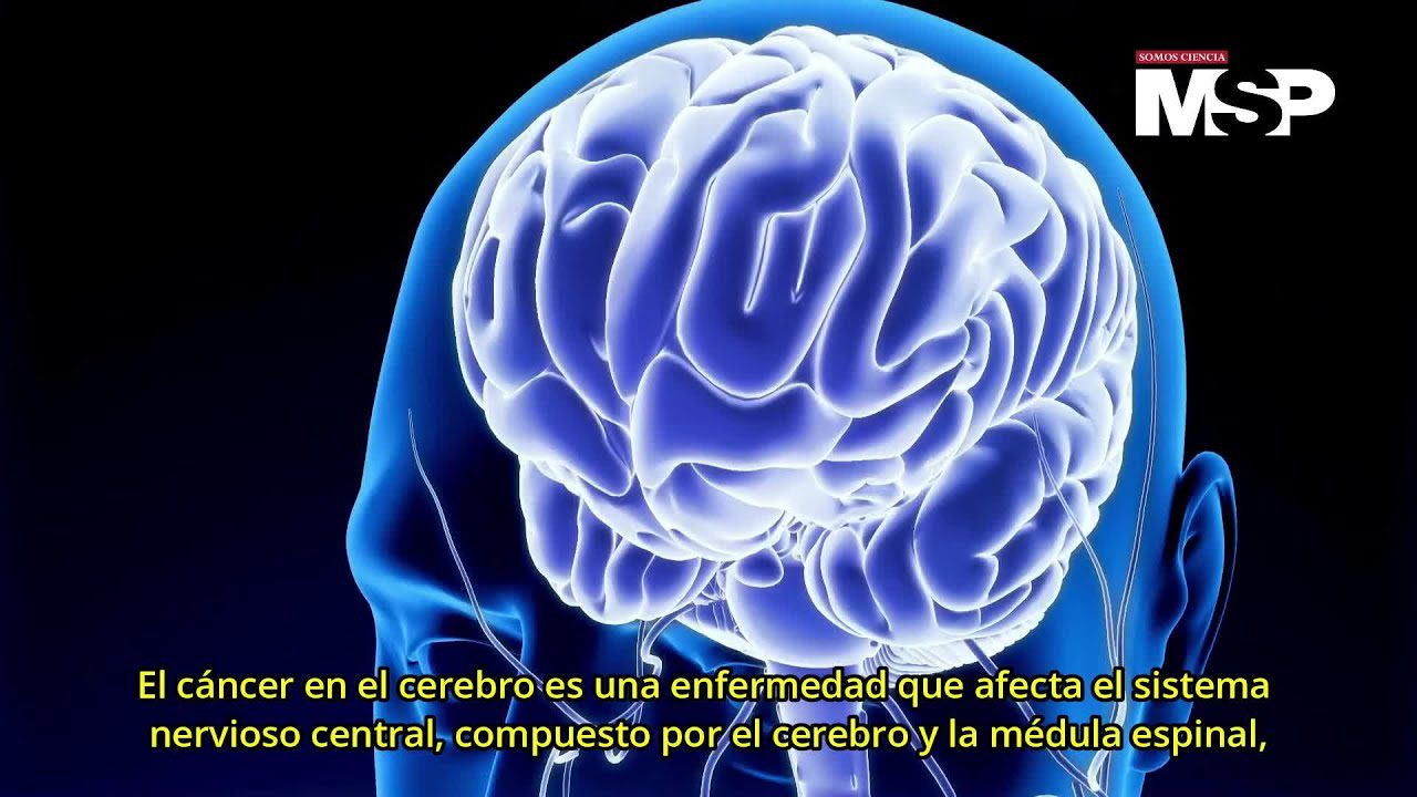 Cómo el cáncer cerebral ha afectado la vida de artistas hispanos
