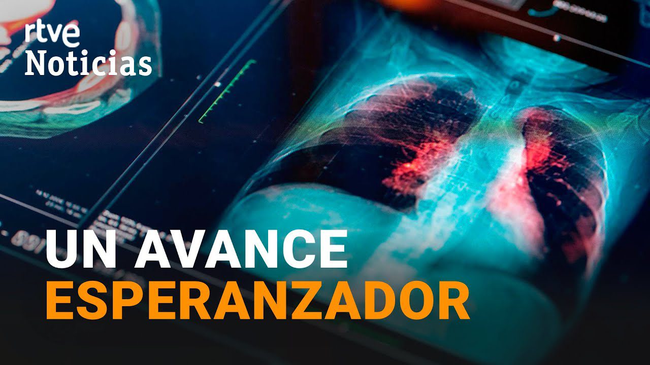 Cómo el cáncer de pulmón ha afectado a artistas hispanos