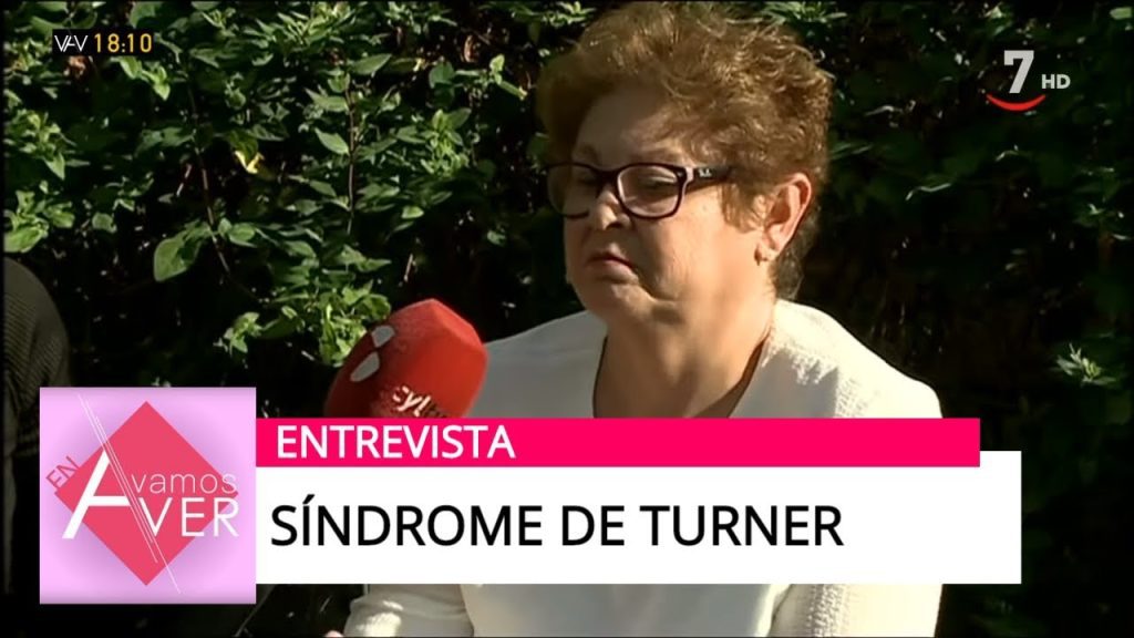 Cómo el síndrome de Turner ha cambiado la vida de artistas hispanas