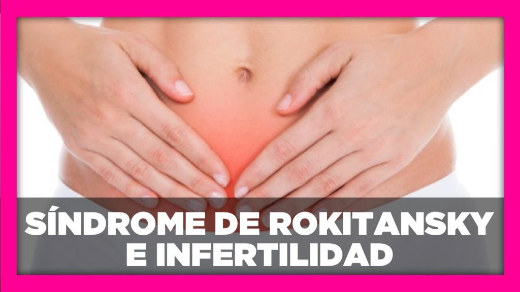 Cómo manejar el síndrome de Rokitansky