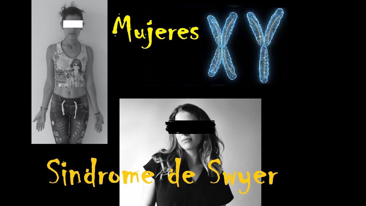 Como-manejar-el-sindrome-de-Swyer - i-Healthcare Cómo manejar el síndrome de Swyer