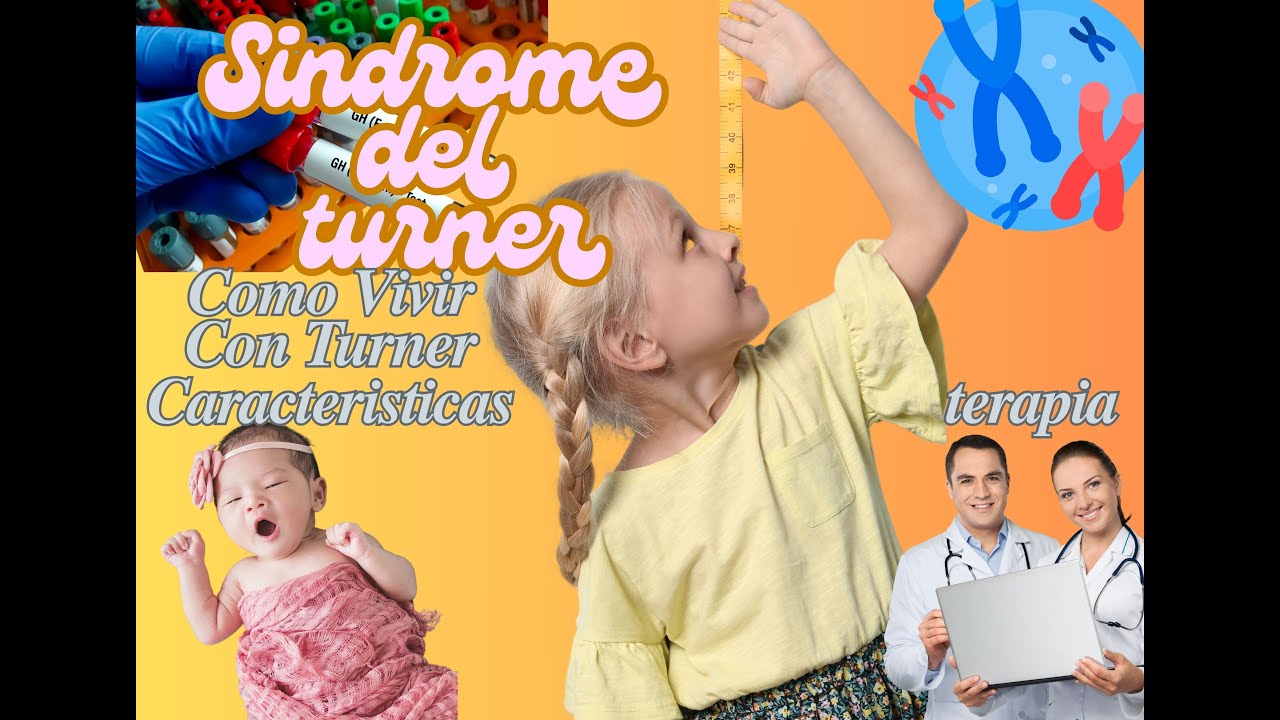 Como-manejar-el-sindrome-de-Turner - i-Healthcare Cómo manejar el síndrome de Turner