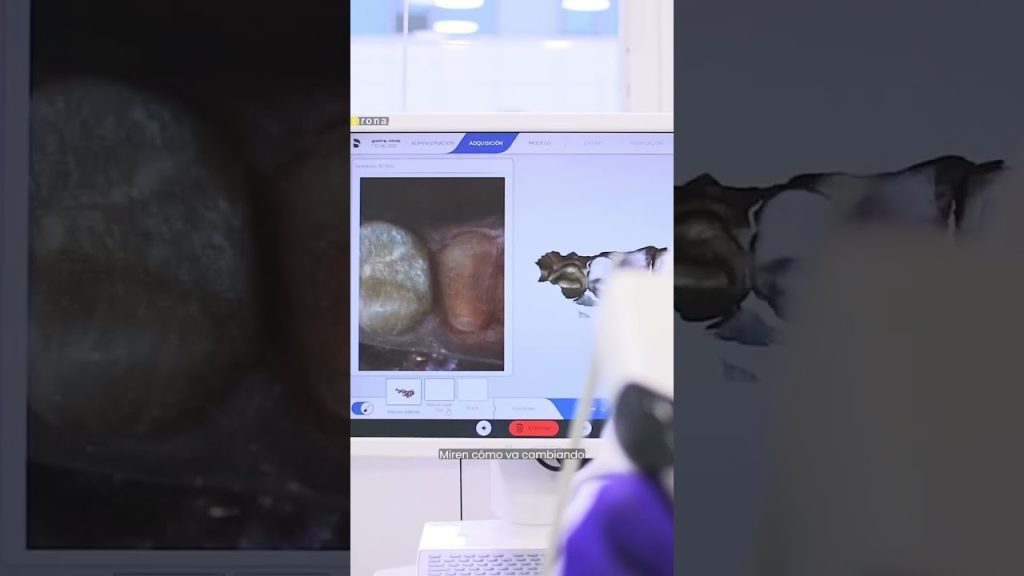 Dentista en  Palacios de la Sierra