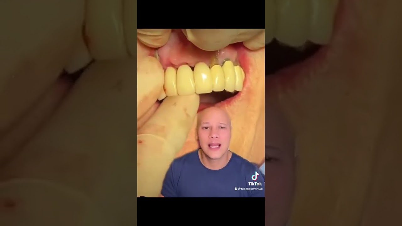 Dentista-en-Puentedura - i-Healthcare Dentista en Puentedura
