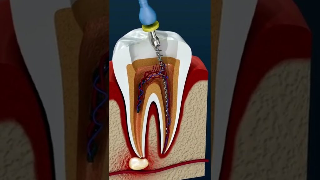 Dentista en  Quintanavides
