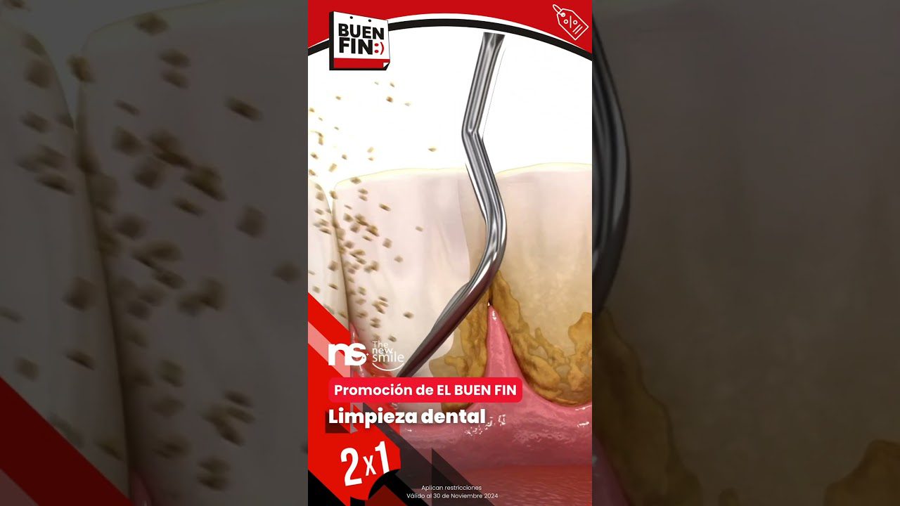 Dentista-en-Rabanera-del-Pinar - i-Healthcare Dentista en Rabanera del Pinar