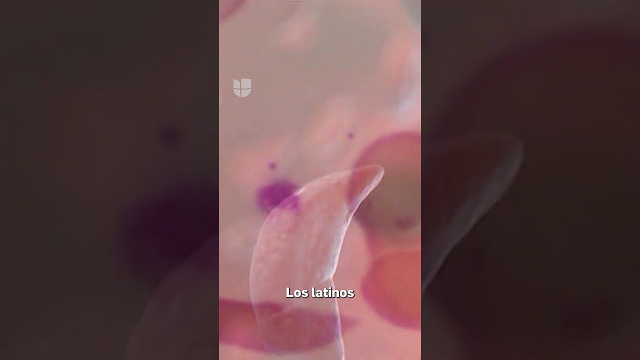 El impacto de la anemia falciforme en la vida de celebridades hispanas