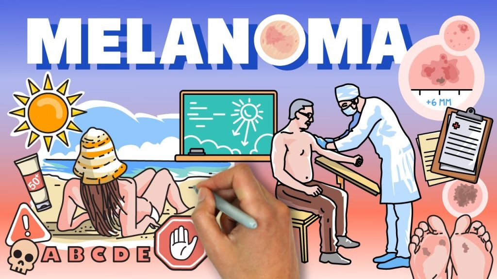 El impacto del melanoma en figuras icónicas de la música y el cine hispano