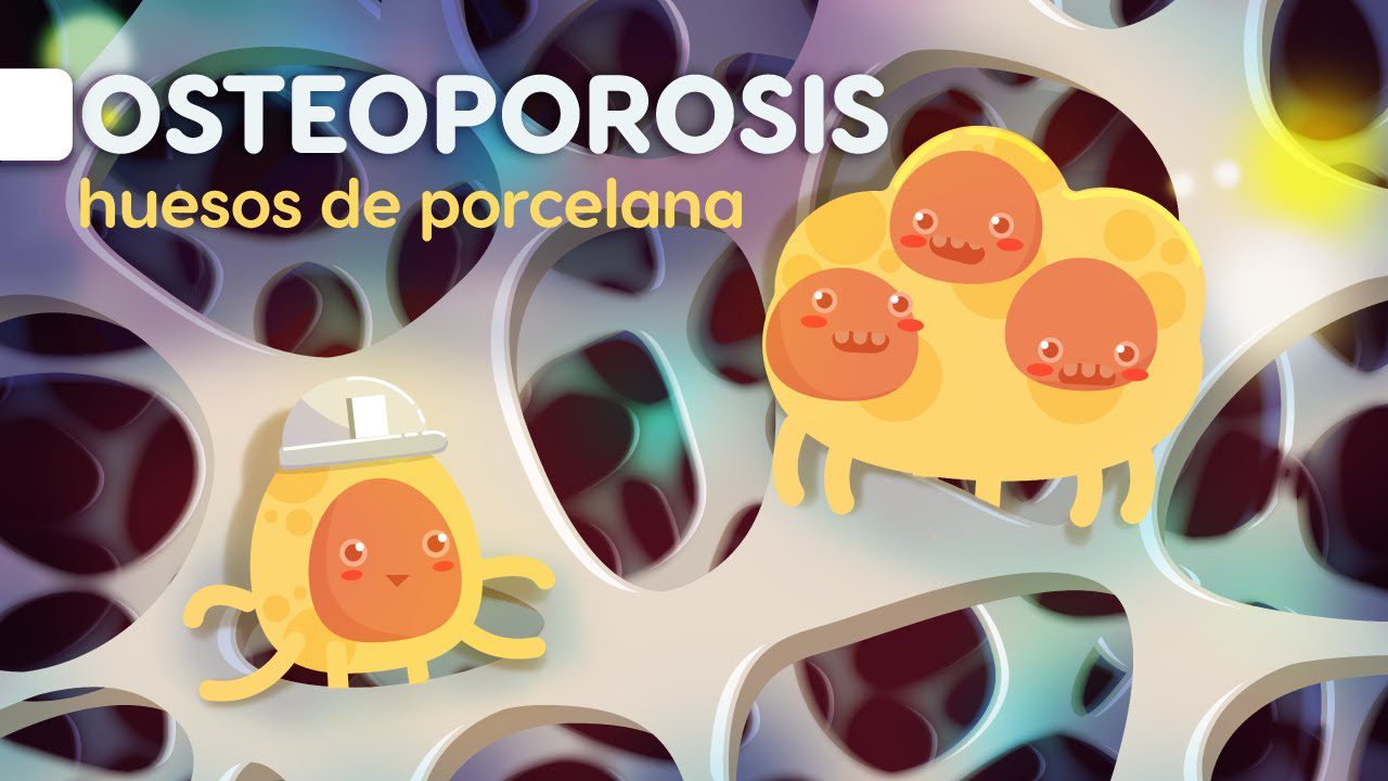 La-salud-osea-en-mujeres-que-saber-sobre-la-osteoporosis - i-Healthcare La salud ósea en mujeres: qué saber sobre la osteoporosis