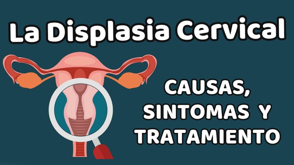 Todo lo que necesitas saber sobre la displasia cervical