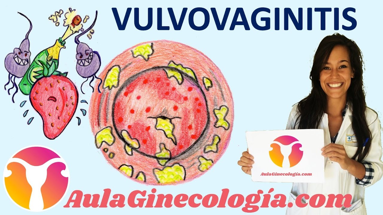 Todo lo que necesitas saber sobre la vulvitis