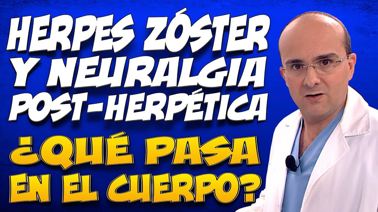 Cómo el herpes zóster ha marcado la vida de figuras públicas latinas