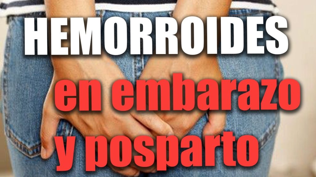 Cómo prevenir y tratar las hemorroides durante el embarazo