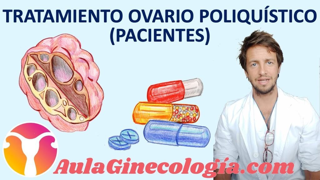 Cómo manejar el síndrome de ovario poliquístico leve