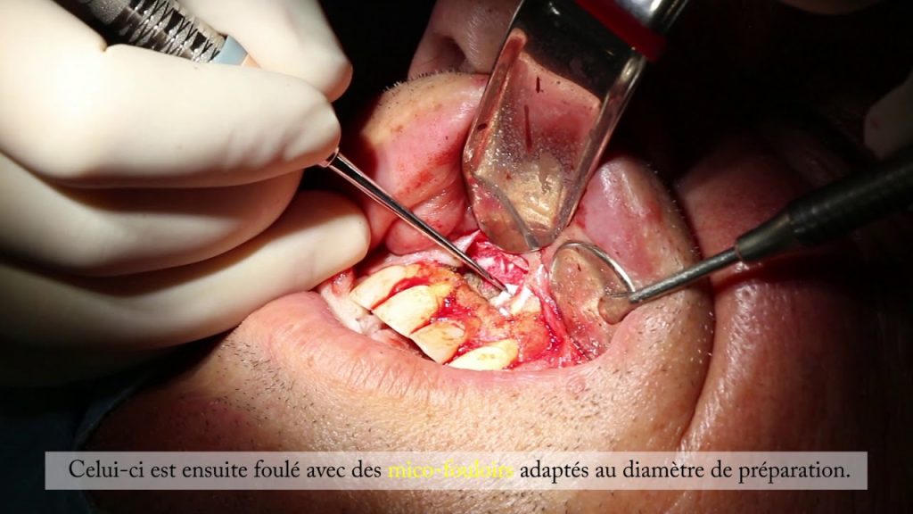 Dentista en  Acehúche