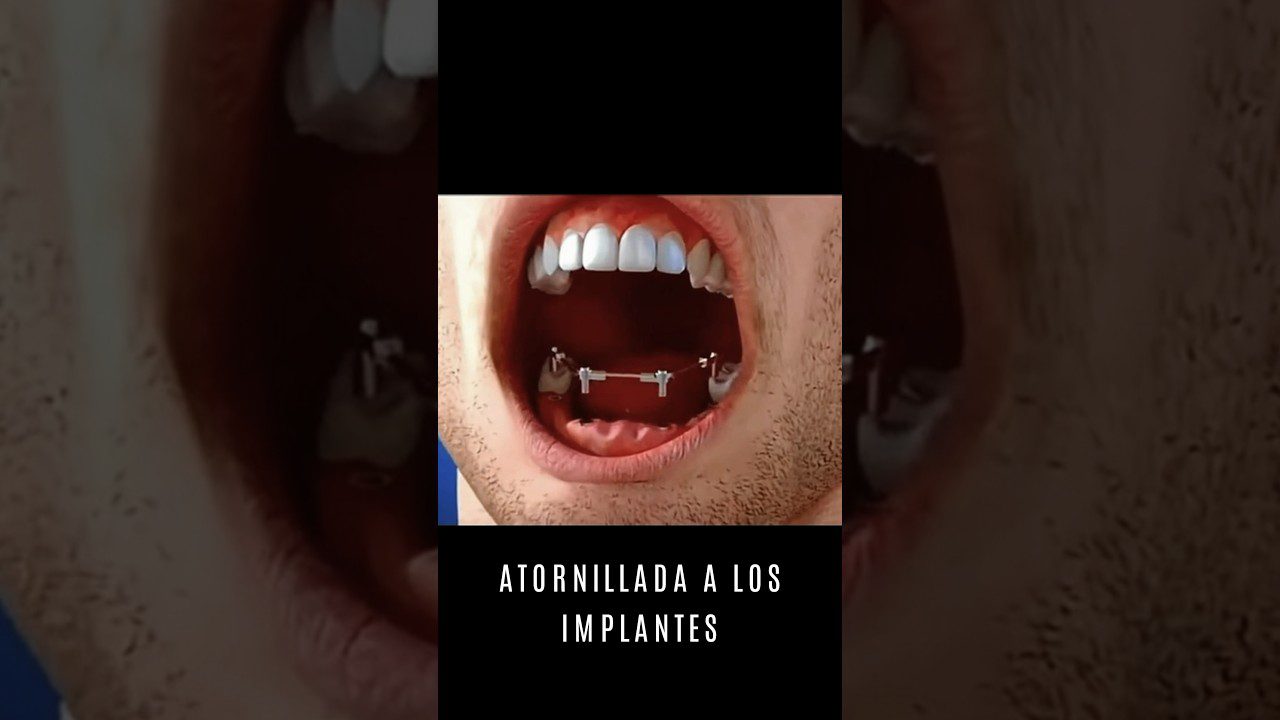 Dentista en  Aceituna
