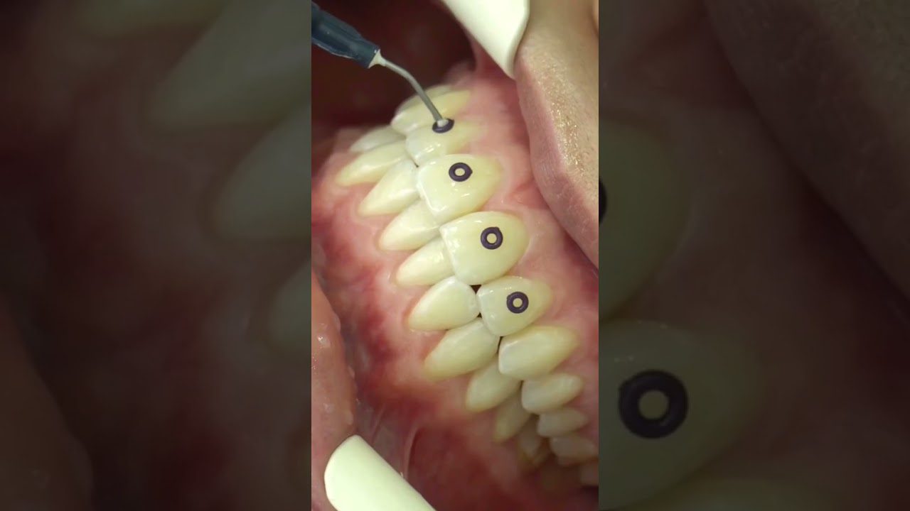 Dentista en  Aldeanueva de la Vera