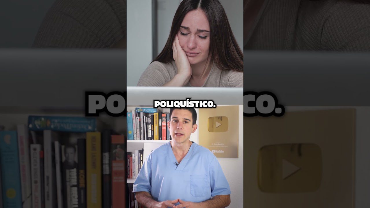 Cómo manejar el síndrome de ovario poliquístico severo