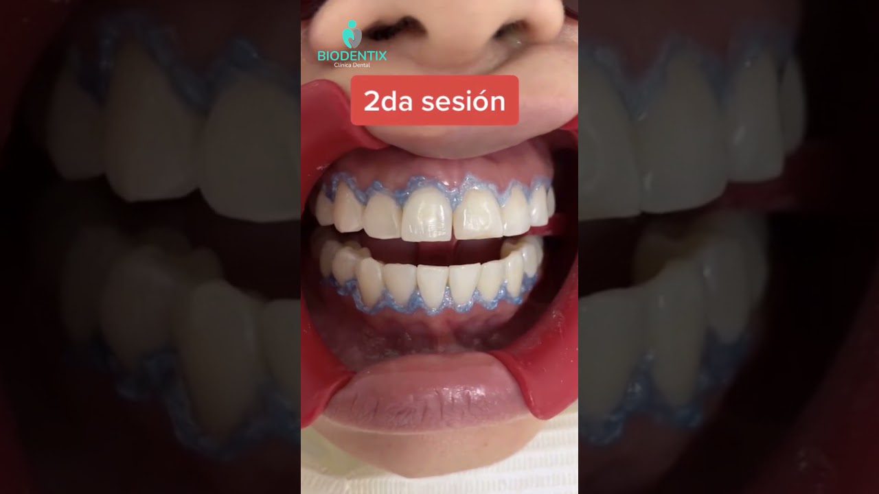 Dentista en  Arroyo de la Luz