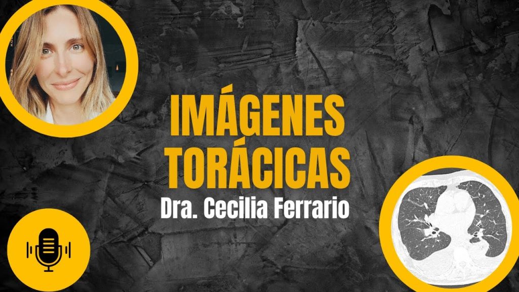 revisión científica de Cómo se aplica la inteligencia artificial en el diagnóstico médico