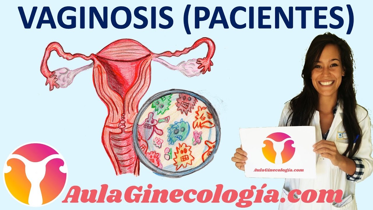 Como-prevenir-y-tratar-la-vaginitis - i-Healthcare Cómo prevenir y tratar la vaginitis