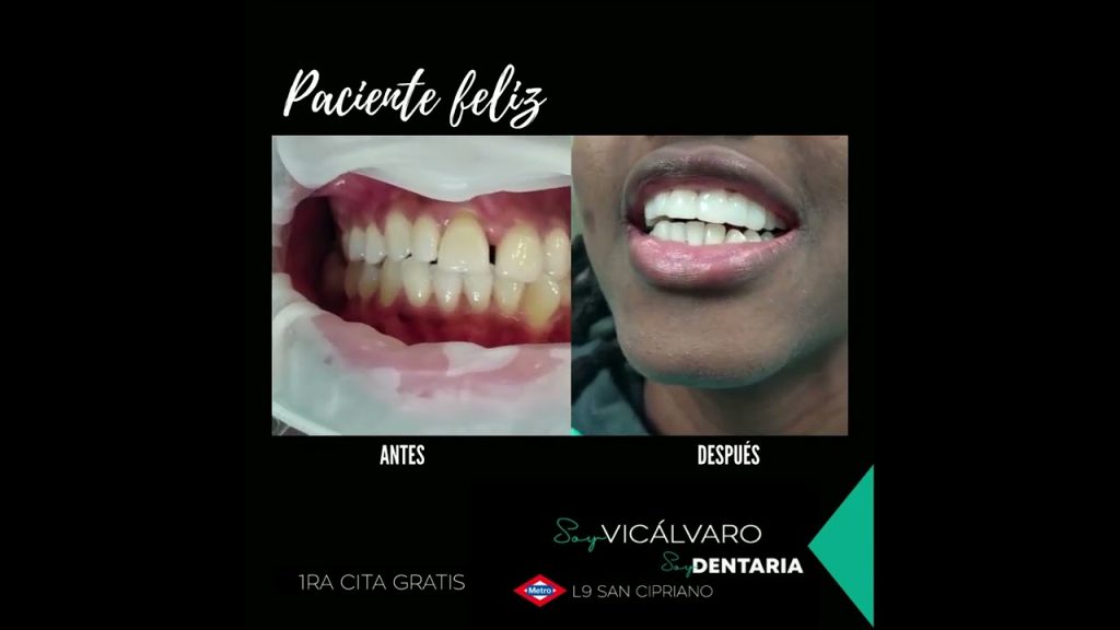 Dentista en  Cañamero