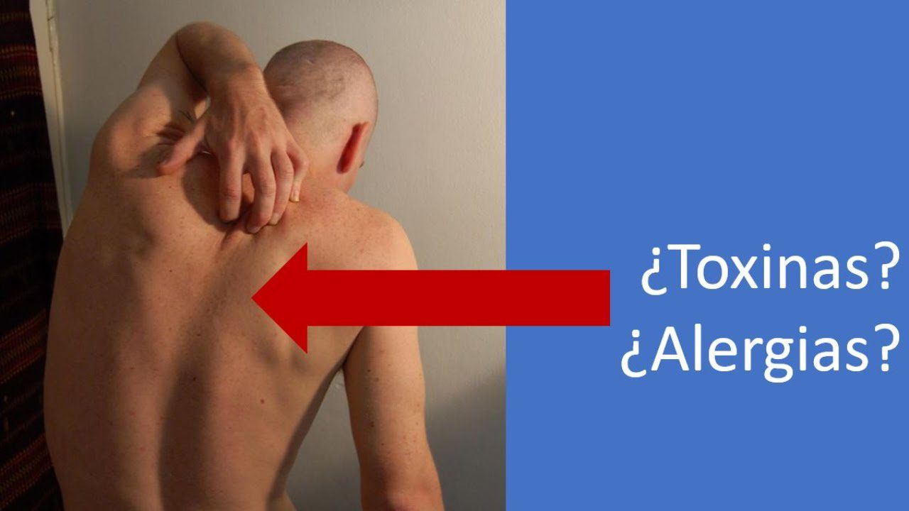 Centro de salud de Picón