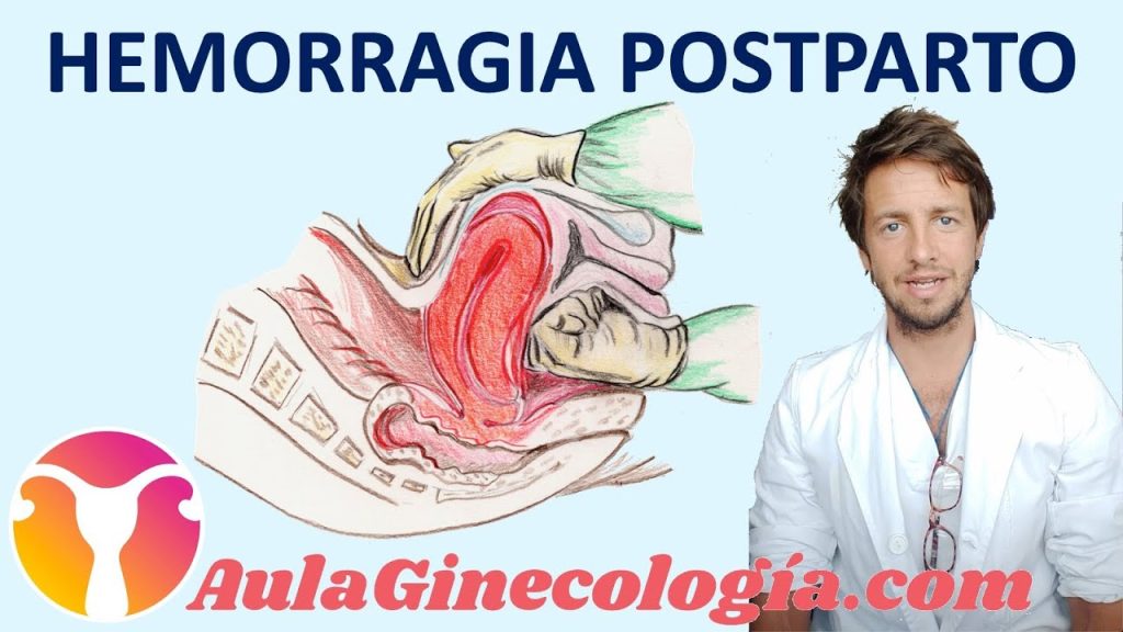 Cómo prevenir y tratar la hemorragia postparto